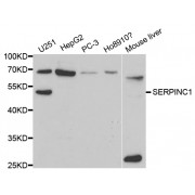 Western blot analysis of extracts of various cell lines, using SERPINC1 antibody (abx001325) at 1/1000 dilution.