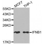 Western blot analysis of extracts of various cell lines, using IFNB1 antibody (abx001326) at 1/1000 dilution.