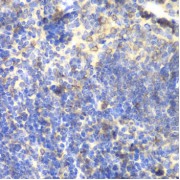 Immunohistochemistry of paraffin-embedded mouse spleen using BTK antibody (abx001327) at dilution of 1/100 (40x lens).