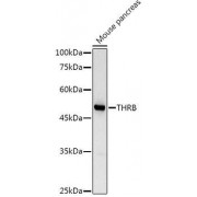 Western blot analysis of extracts of Mouse pancreas, using THRB antibody (abx001332) at 1/1000 dilution.