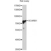 Western blot analysis of extracts of rat ovary, using SCARB1 Antibody (abx001334) at 1/1000 dilution.