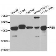 Western blot analysis of extracts of various cell lines, using REN antibody (abx001335) at 1/1000 dilution.