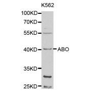 Western blot analysis of extracts of K-562 cells, using ABO antibody (abx001336) at 1/1000 dilution.