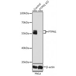 Tyrosine-Protein Phosphatase Non-Receptor Type 1 (PTPN1) Antibody