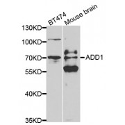 Western blot analysis of extracts of various cell lines, using ADD1 antibody (abx001340) at 1/500 dilution.