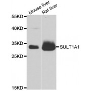 Western blot analysis of extracts of various cell lines, using SULT1A1 antibody (abx001346) at 1/1000 dilution.