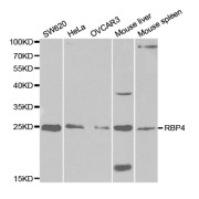 Western blot analysis of extracts of various cell lines, using RBP4 antibody (abx001347) at 1/1000 dilution.