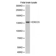 Western blot analysis of extracts of fetal brain, using ERCC5 antibody (abx001349).