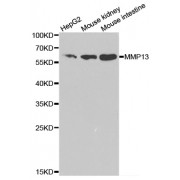 Western blot analysis of extracts of various cell lines, using MMP13 antibody (abx001350) at 1/1000 dilution.