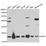 Western blot analysis of extracts of various cell lines, using DHFR antibody (abx001351) at 1/1000 dilution.