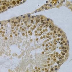 ELAV (Embryonic Lethal, Abnormal Vision, Drosophila)-Like 1 (Hu Antigen R) (ELAVL1) Antibody