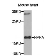 Western blot analysis of extracts of mouse heart, using NPPA antibody (abx001353) at 1/1000 dilution.