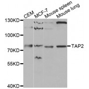 Western blot analysis of extracts of various cell lines, using TAP2 antibody (abx001354) at 1/1000 dilution.