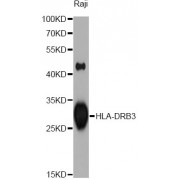 Western blot analysis of extracts of Raji cells, using HLA-DRB3 antibody (abx001355) at 1/1000 dilution.