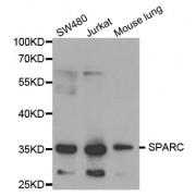 Western blot analysis of extracts of various cell lines, using SPARC antibody (abx001359) at 1/1000 dilution.