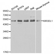 Western blot analysis of extracts of various cell lines, using KIR3DL1 antibody (abx001361) at 1/1000 dilution.