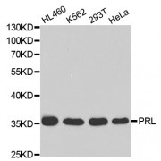 Western blot analysis of extracts of various cell lines, using PRL antibody (abx001362) at 1/1000 dilution.