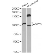Western blot analysis of extracts of various cell lines, using DPYD Antibody (abx001364) at 1/1000 dilution.
