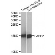 Western blot analysis of extracts of various cell lines, using FABP2 antibody (abx001365) at 1/500 dilution.