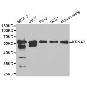 Western blot analysis of extracts of various cell lines, using KPNA2 antibody (abx001367) at 1/1000 dilution.