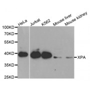 Western blot analysis of extracts of various cell lines, using XPA antibody (abx001370) at 1/1000 dilution.