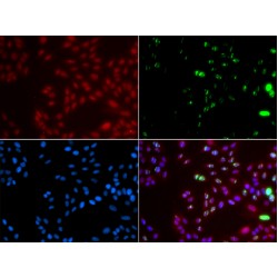 DNA Repair Protein Complementing XP-A Cells (XPA) Antibody