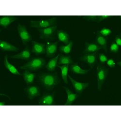 DNA Repair Protein Complementing XP-A Cells (XPA) Antibody