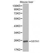 Western blot analysis of extracts of mouse liver, using GSTA1 antibody (abx001371) at 1/1000 dilution.