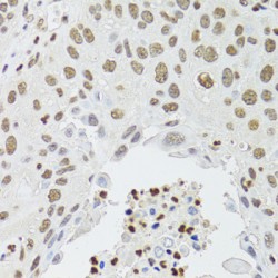 Homeobox Protein CDX-2 (CDX2) Antibody
