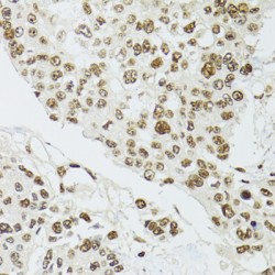 Homeobox Protein CDX-2 (CDX2) Antibody