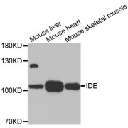 Western blot analysis of extracts of various cell lines, using IDE antibody (abx001373) at 1/1000 dilution.