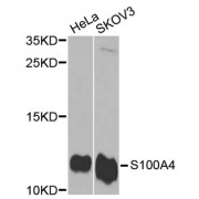 Western blot analysis of extracts of various cell lines, using S100A4 antibody (abx001374) at 1/1000 dilution.