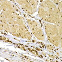 Protein S100-A4 (S100A4) Antibody