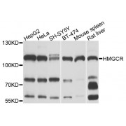 Western blot analysis of extracts of various cell lines, using HMGCR antibody (abx001376) at 1/1000 dilution.