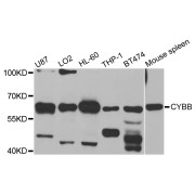 Western blot analysis of extracts of various cell lines, using CYBB antibody (abx001378) at 1/1000 dilution.