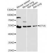 Western blot analysis of extracts of various cell lines, using ETV6 antibody (abx001379) at 1/1000 dilution.