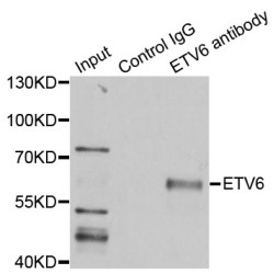 ETS Translocation Variant 6 (ETV6) Antibody