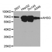 Western blot analysis of extracts of various cell lines, using AHSG antibody (abx001387) at 1/1000 dilution.
