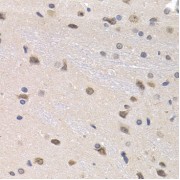 Immunohistochemistry of paraffin-embedded rat brain using PTHLH antibody (abx001391) at dilution of 1/200 (40x lens).