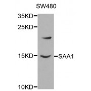Western blot analysis of extracts of SW480 cells, using SAA1 antibody (abx001392) at 1/1000 dilution.