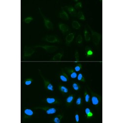 UDP-Glucuronosyltransferase 1-9 (UGT1A9) Antibody