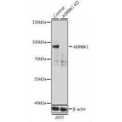 Adrenergic Receptor Beta Kinase 1 (ADRBK1) Antibody