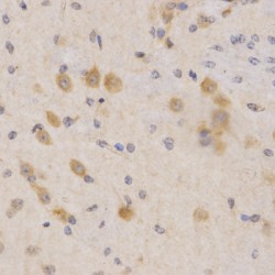 Phosphoinositide Dependent Protein Kinase 1 (PDPK1) Antibody