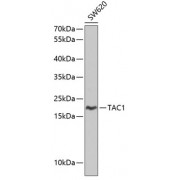 Western blot analysis of extracts of SW620 cells, using TAC1 antibody (abx001400) at 1/1000 dilution.