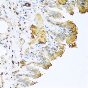 Immunohistochemistry of paraffin-embedded mouse lung using VTN antibody (abx001401) at dilution of 1/100 (40x lens).