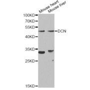 Western blot analysis of extracts of various cell lines, using DCN Antibody (abx001402) at 1/1000 dilution.