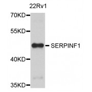 Western blot analysis of extracts of 22Rv1 cells, using SERPINF1 antibody (abx001406) at 1/1000 dilution.