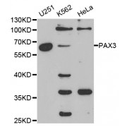 Western blot analysis of extracts of various cell lines, using PAX3 antibody (abx001407) at 1/1000 dilution.