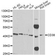 Western blot analysis of extracts of various cell lines, using CD38 Antibody (abx001411) at 1/500 dilution.