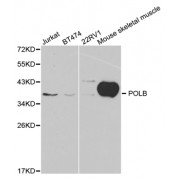 Western blot analysis of extracts of various cell lines, using POLB antibody (abx001412) at 1/1000 dilution.